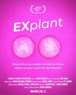 Watch Explant Sockshare