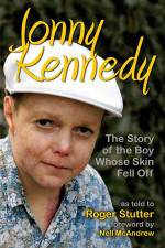 Watch The Boy Whose Skin Fell Off Sockshare
