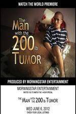 Watch The Man With The 200lb Tumor Sockshare